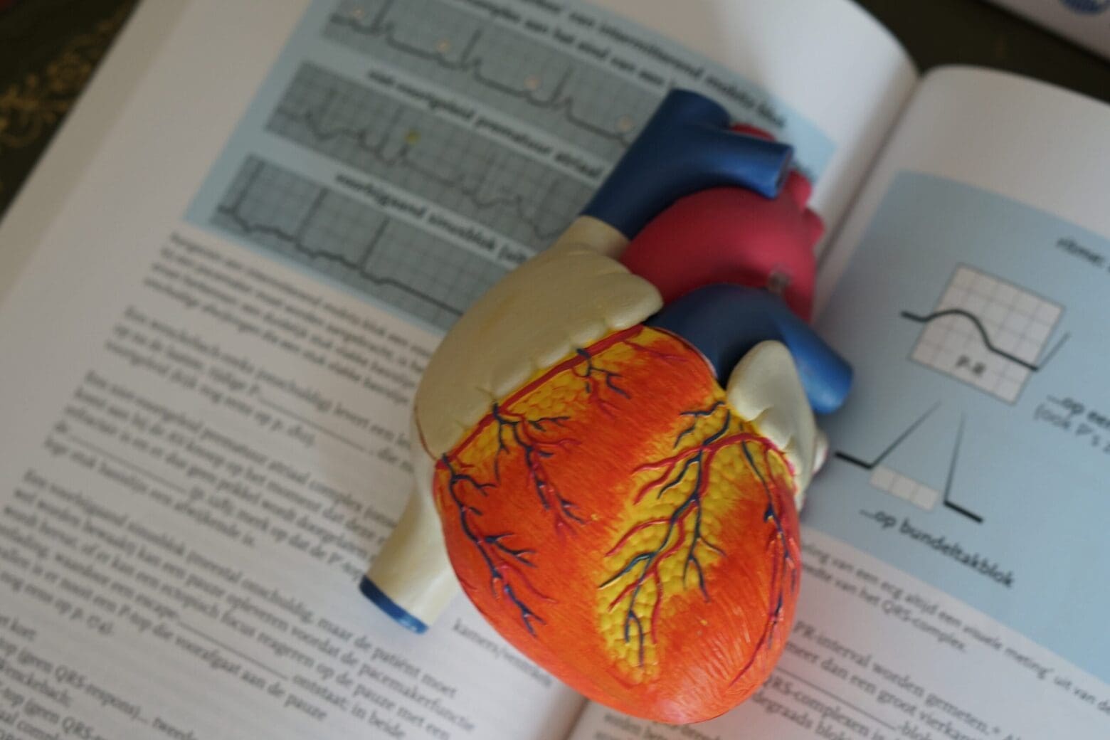 Reading and interpreting ECGs