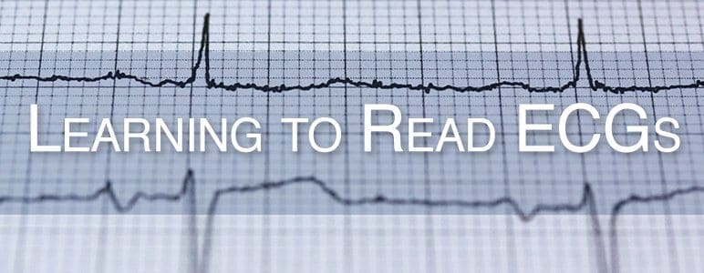 Learning to Read ECGs